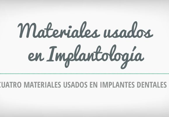 Materiales usados en implantología [Infografía]