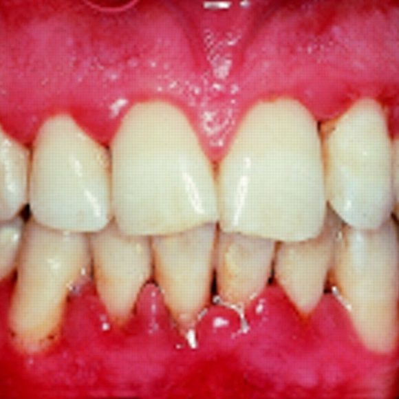 Periodoncia