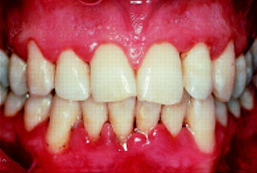 Periodoncia
